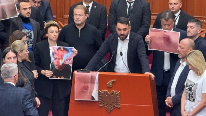 Açka akuzon drejtuesit e PD-së/ “Protesta është teatër, demokratët i çuat pas diellit”